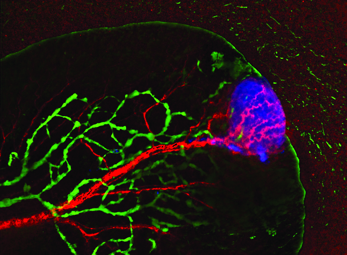 Non-invasive image from the bioimaging center showing blood (red) and lymphatic (green) vessels that were induced to grow by, and in tum facilitate progression of a growing tumor (blue).The ability of tumors to induce local expansion of blood and lymphatic vessels is a critical step in tumor progression and metastatic spread. Targeting these vessels provides an important strategy for novel anti-cancer treatment. Image courtesy Prof. Michal Neeman