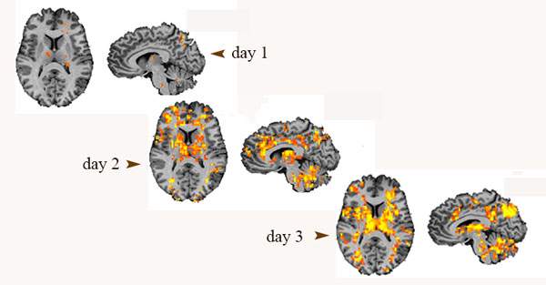 דימות תיפקודי בתהודה מגנטית מגלה, כי החיבורים במוח (בצהוב ובכתום) התחזקו בעקבות הנוירופידבק ביום השני והשלישי של הניסוי. הנבדקים לא היו מודעים לתהליך הלמידה