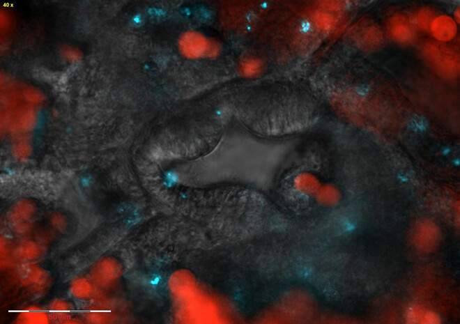 "פיו" של פוליפ אלמוג (במרכז). אצות שיתופיות מסומנות באדום, חיידקים גורמי מחלות שנכנסו לאיזור מסומנים בכחול