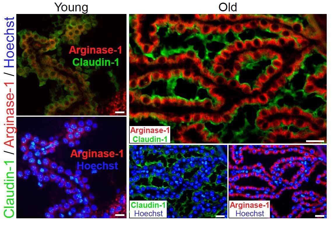 The choroid plexus (CP) of young (3 months) and aged (22 months) mice immunostained for Claudin-1 (tight-junction marker; green), Arginase-1 (red), and Hoechst nuclear staining (blue), showing elevation of araginase-1 on the CP epithelium during aging