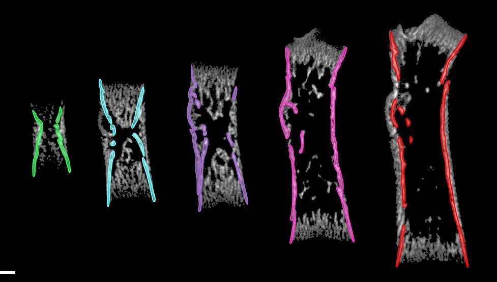 Bones of mice at different ages, imaged with three-dimensional computer tomography. A core element at the center of the bone (highlighted in different colors) enabled the scientists to align different bones for comparison
