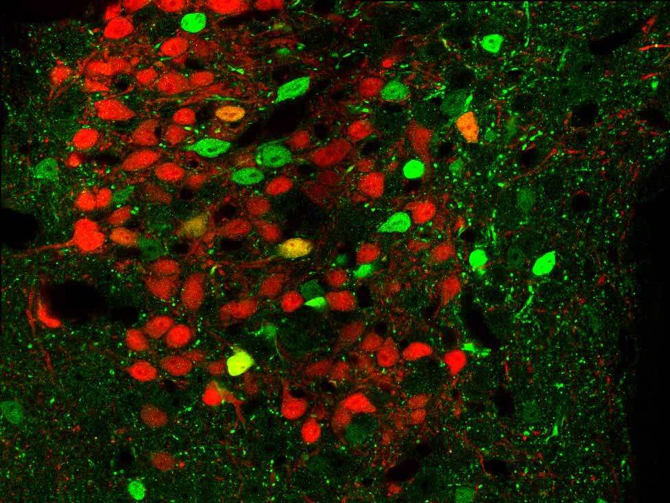 Brain tissue from genetically engineered mice. Neurons that express CRFR1 appear in green and those that release the neurotransmitter CRF are in red. The image was obtained with fluorescence microscopy