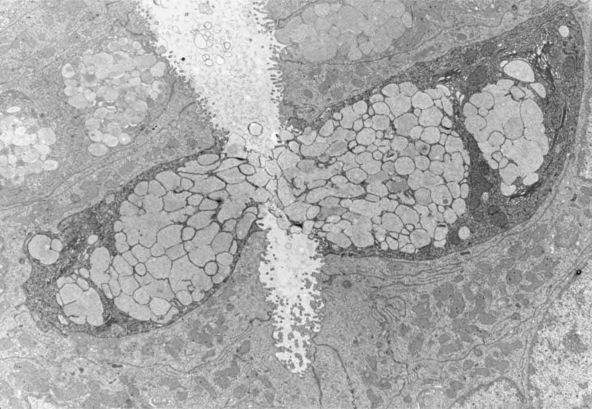 Tunneling electron microscope image captures two goblet cells secreting their contents into the intestine 
