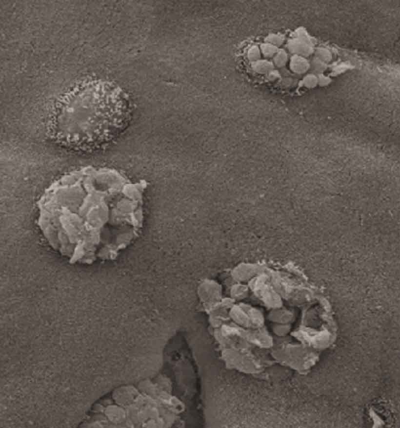 Scanning electron microscope image of the inside of the gut lining. Note the vesicles protruding from the surface of the goblet cells, prior to release. In inflammasome-free mice, these vesicles are not released