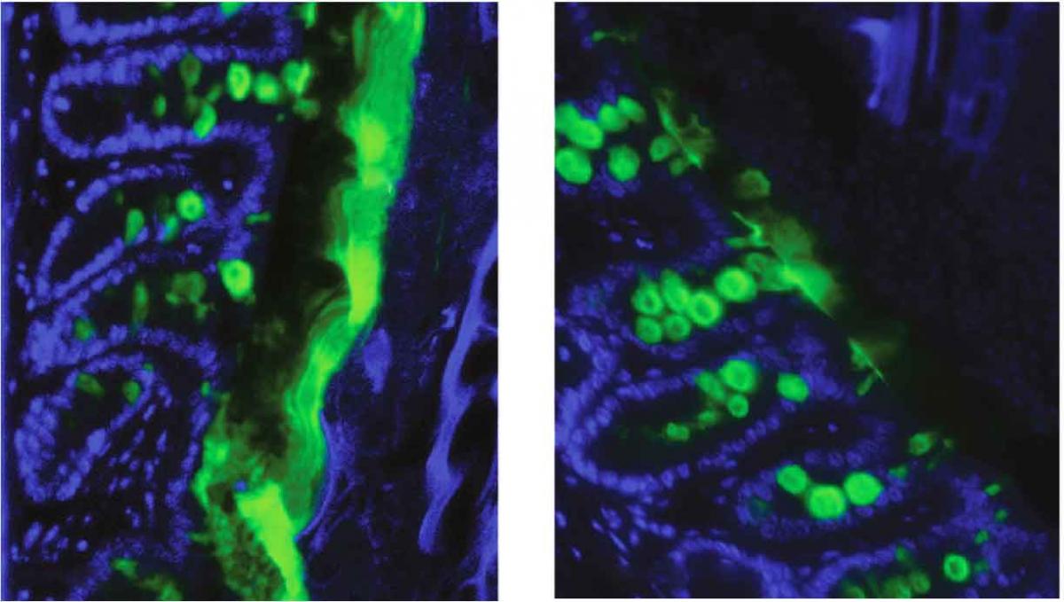 n the gut of a normal mouse (left) there is a thick, internal layer of mucus (wide green stripe), while an inflammasome-free mouse (right) does not produce this layer