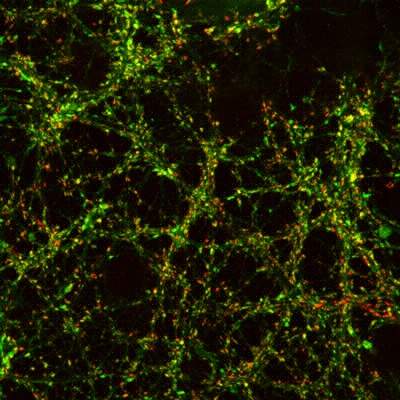 A dense network of synapses in cultured neurons from a rat brain. Red dots represent synaptic connections and green dots are a special fluorescent protein that allows Dr. Ofer Yizhar and his group to record the activity of these synapses