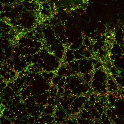 הנקודות האדומות מסמנות סינפסות, צמתי תקשורת בין נוירונים. הנקודות הירוקות נוצרות כתוצאה מנוכחות ופעילות של חלבון פלואורוסצנטי אשר מאפשר למדענים לעקוב בזמן אמיתי אחרי פעולתן של הסינפסות המסומנות