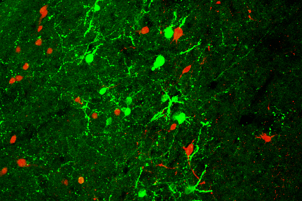 ביטוי של יורוקורטין-3 (בירוק) והקולטן שלו (באדום), המעורבים בהתמודדות עם לחץ באיזור האחראי להתנהגות חברתית במוח עכבר. צולם באמצעות מיקרוסקופ קונפוקלי