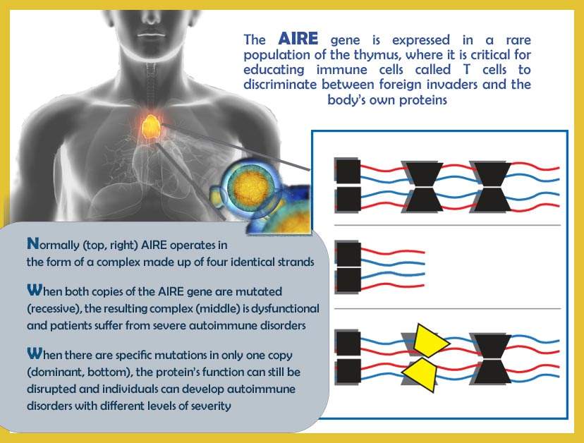 AIRE infographic
