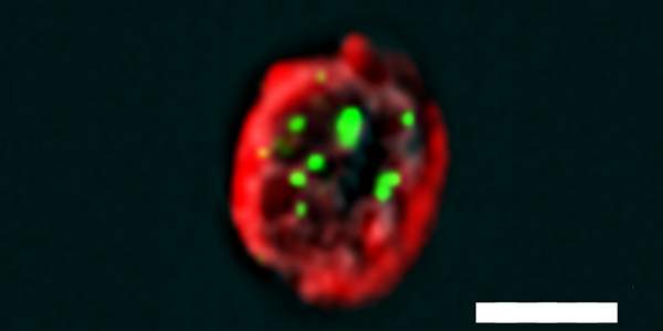 Cellular “selfie”: an mTEC cell viewed by means of the new method, called PLIC. The green dots reveal a protein interaction that helps prevent an autoimmune attack