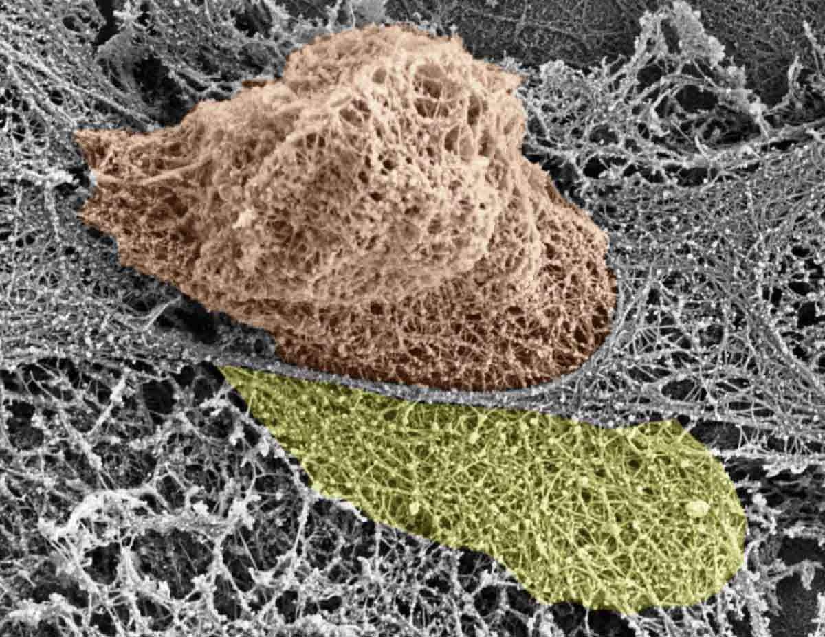 White blood cell squeezing through endothelial cells (grey) on its way out of the blood vessel walls. The actin cytoskeleton of both cells is exposed; the white blood cell nucleus is shown in brown and the large actin rich extension that dismantles the endothelial actin is shown in yellow 