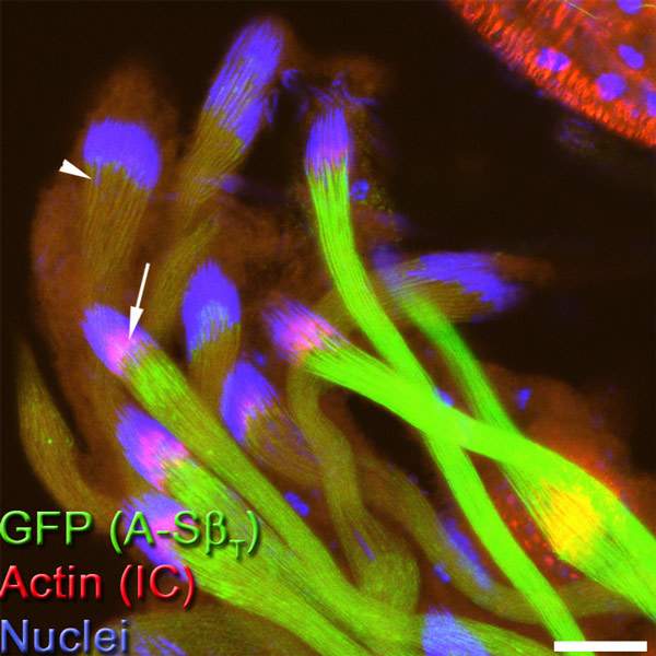 A-S-beta protein (green) is a sign that the sperm cells have reached the proper energy level to undergo individualization