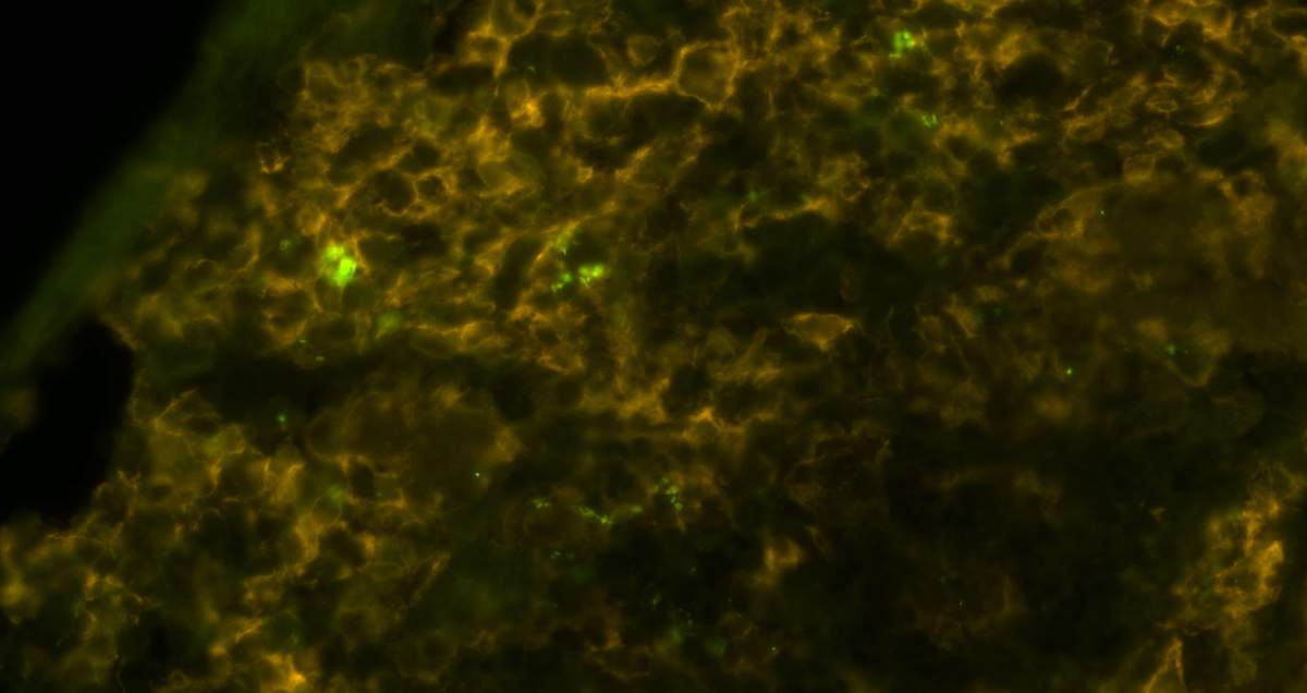 Salmonella (bright green) inside macrophages (brownish yellow), viewed under a microscope