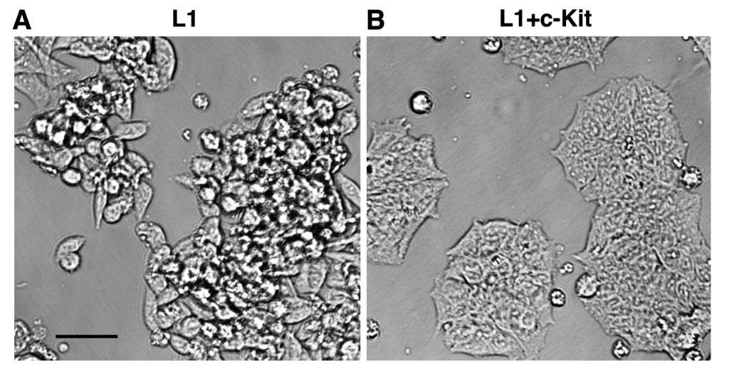 Without the c-Kit gene, colon cancer cells grow in a disorderly, aggregated manner and are invasive (A); when c-Kit expression is restored in these cells, they revert to a more normal organization (B) 
