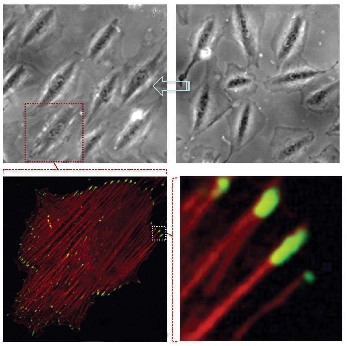 Top right: Before force is applied, cells grown in culture are randomly oriented. Top left: As a result of cyclic stretching, the cells organize in a uniform orientation. Bottom left: Following the cyclic stretching, cell skeletal fibers (“compressed springs,” red) align at the same angle as the cell body. Bottom right: Focal adhesions (green) at the ends of cellular skeleton fibers (red)