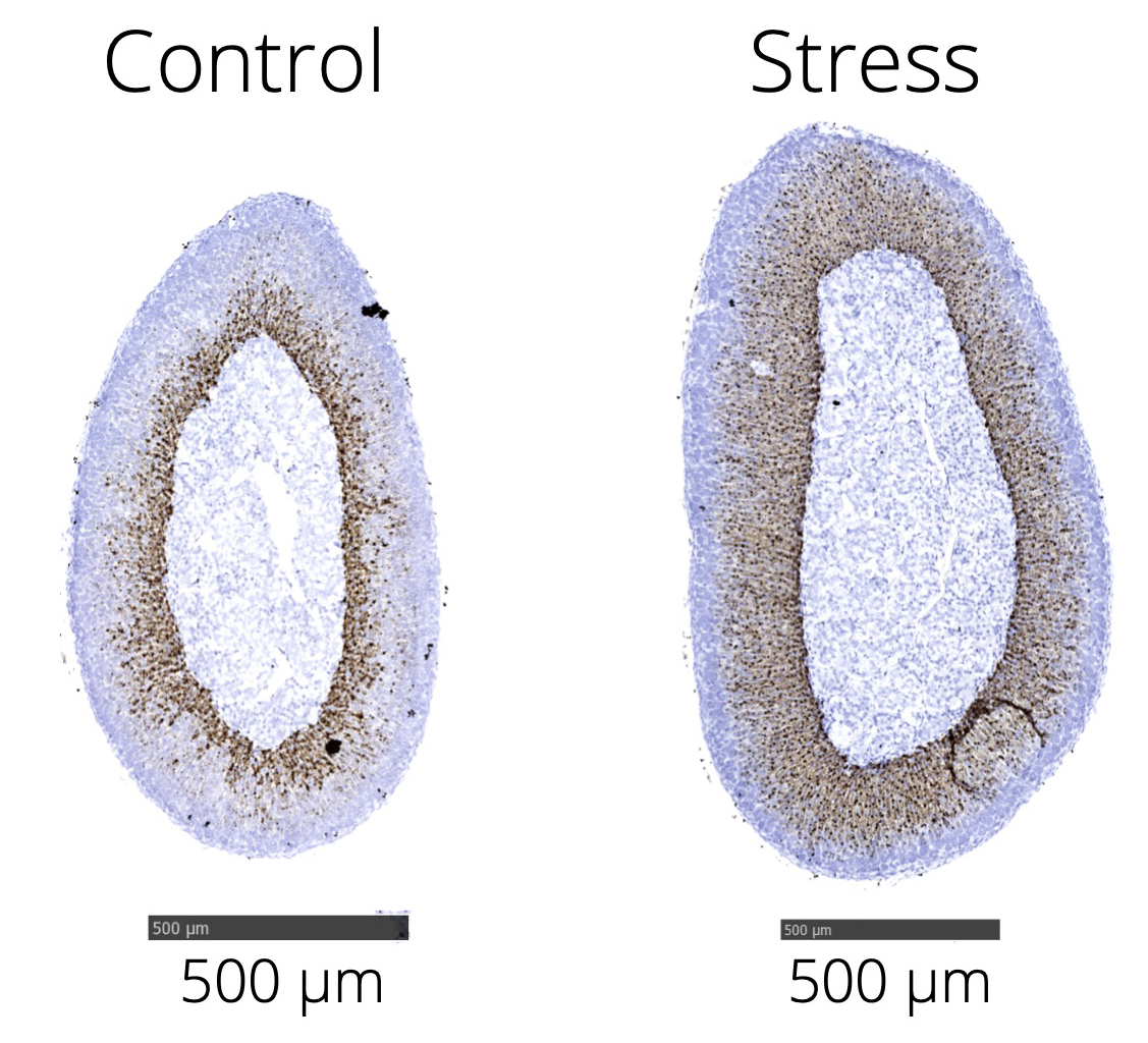 Chronic stress leads to a significant increase in adrenal size and the mRNA expression of Abcb1b (brown staining) in the adrenal cortex of stressed mice (r) compared to that of controls. Scale bars 500 microns