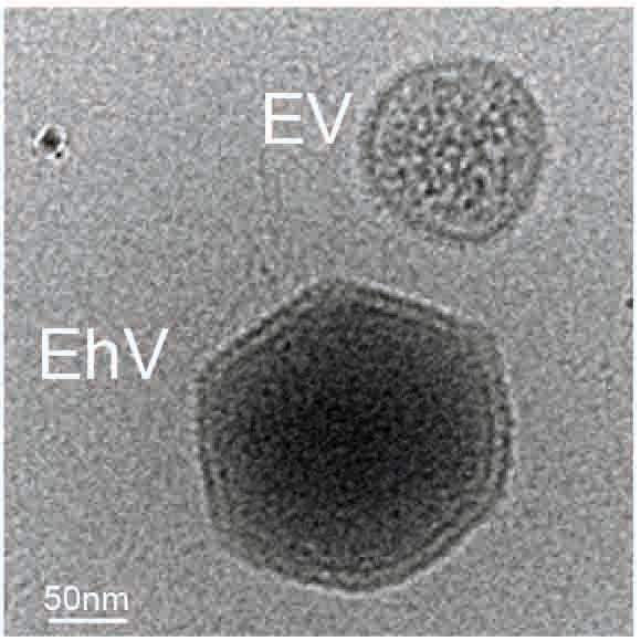 Cryo-TEM image of a virus (EhV) and a vesicle (EV)