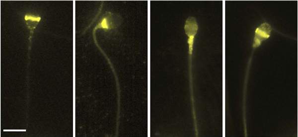 Locations of different opsins on the human sperm, viewed under a microscope, are revealed by labeling with a fluorescent antibody (bright yellow)