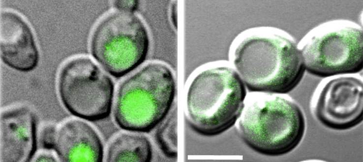  A green fluorescent-labeled protein serves as a marker for autophagy. Autophagy occurs when the protein accumulates within the relevant organelle (left); when diffused throughout the cell (right), the labeled protein signals that no autophagy is taking place 