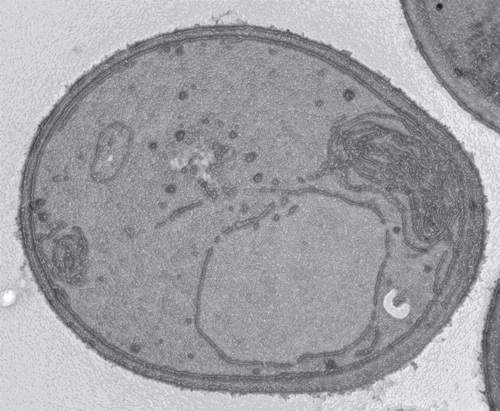  A yeast cell genetically engineered not to produce lipid droplets, viewed under an electron microscope. After exposure to certain stressful conditions, the organelle called endoplasmic reticulum (top right corner) has become abnormally enlarged, which suggests a connection between this organelle and lipid droplets