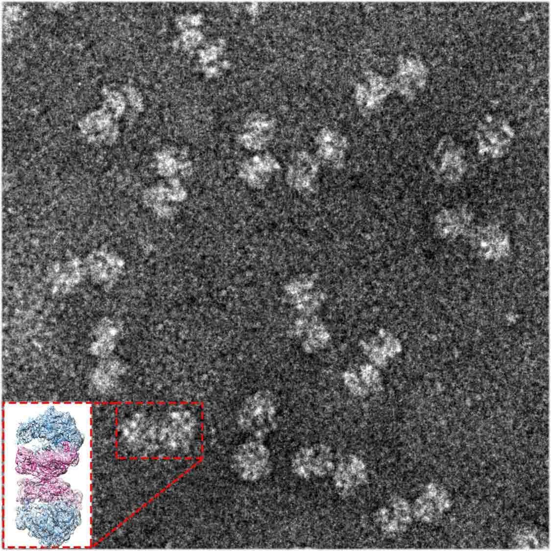 Electron microscope image of paired ribosomes taken from gram-negative bacteria