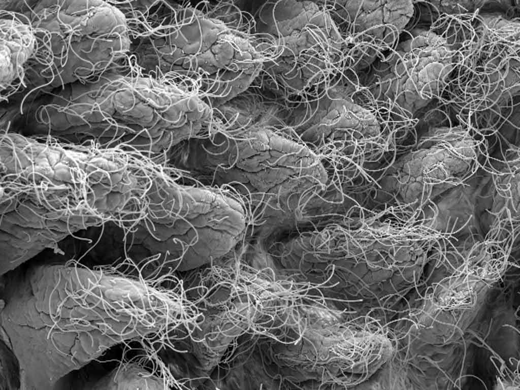 Electron microscope image of a healthy mouse small intestine showing bacteria (strings) surrounding the gut villi (protrusions). A human small intestine looks very similar