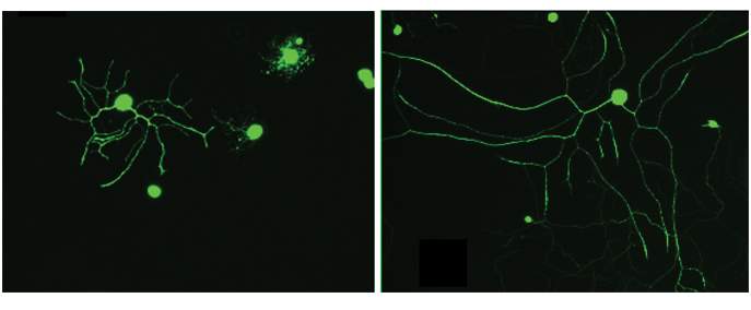 Mouse neurons lacking a major size-sensing molecule, importin-beta1, have a distorted “body image” and grow much longer extensions (right) than regular mice (left), viewed under an automated fluorescence imaging microscope