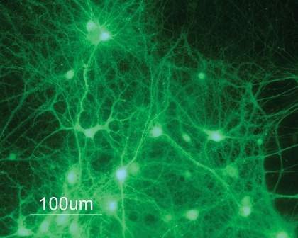 Fluorescent microscope photo of mouse cortical nerve cells (neurons) in culture infected with lentiviruses that express green fluorescent protein