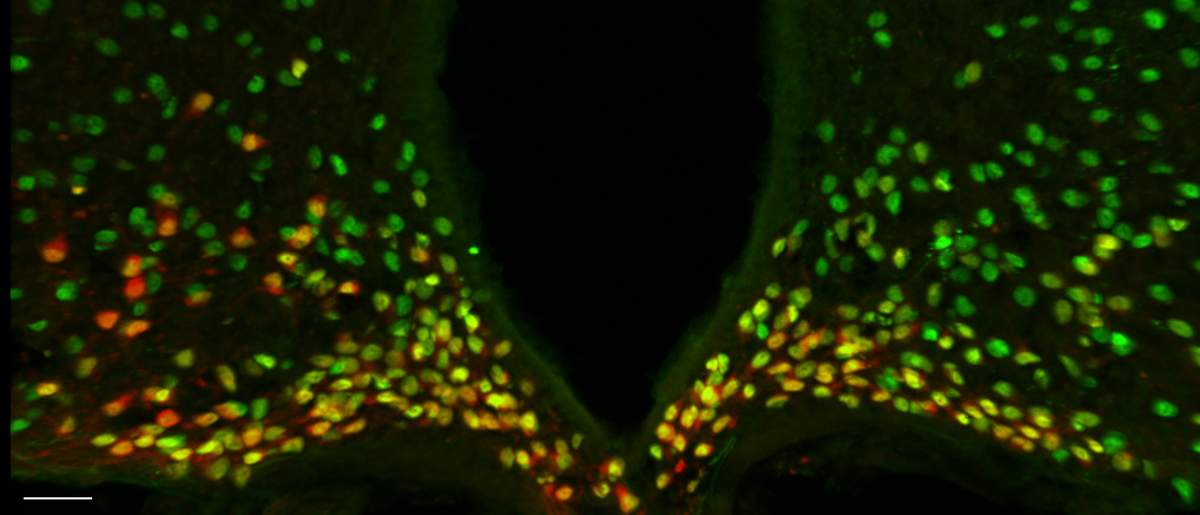 A portion of the mouse hypothalamus reveals that the protein made by the Otp gene (green) is expressed in all the neurons (red) that drive hunger – and the combined color is therefore yellow. It was known that in the developing brain, Otp is needed for the generation of these neurons. The study found that during adulthood, Otp is crucial for causing these neurons to express AgRP, a major hunger-promoting substance