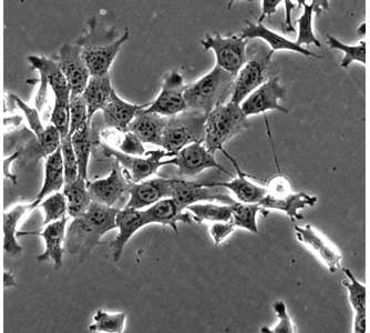 A group of breast carcinoma cells (line 4T1), growing in culture, viewed by light microscopy. Tethers can be seen inter-connecting the collectively migrating cells