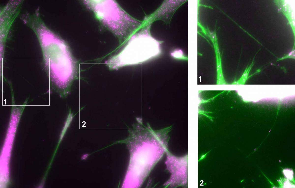 Shown are mouse embryonic fibroblast cells in which a green marker labels the cytoskeleton and enables the observation of nanotubes (seen as fine hair-like projections extending between cells). The RNA is labeled with a magenta marker and each dot indicates an RNA molecule. In the two enlargements (right), some RNA molecules can be observed to localize within nanotubes