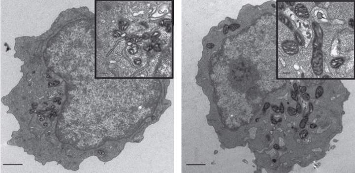  Mitochondria (dark gray), viewed under an electron microscope, are significantly enlarged in blood-forming stem cells lacking MTCH2 (right) compared with regular blood-forming stem cells (left) 