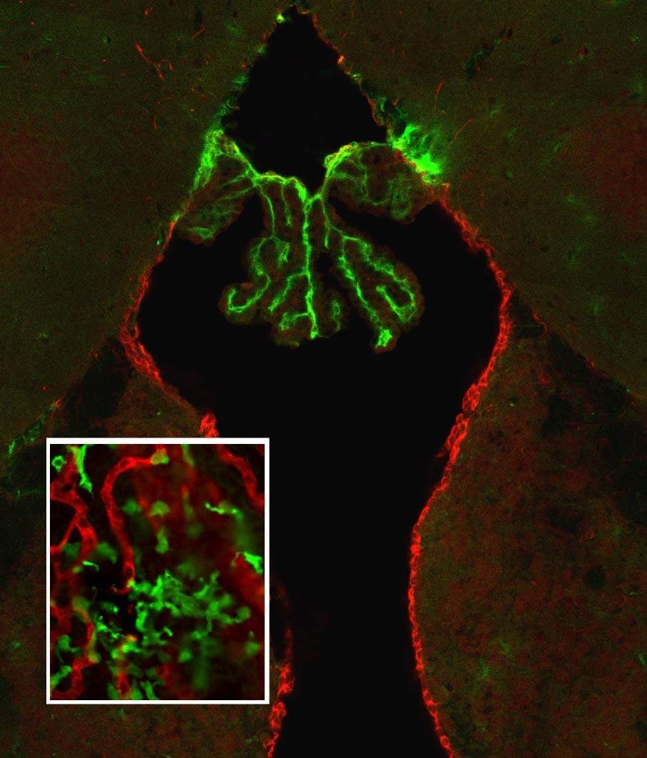 Immunostaining of brain section in which the epithelial choroid plexus expresses TGF-β (green), hanging in the brain ventricle, the keyhole-like structure delineated by the ependymal lining (red). In the box, monocytes (green) entering via the choroidal vasculature. The composition reflects the immune-educative nature of the choroid plexus as a gatekeeper of the route to the injured parenchyma