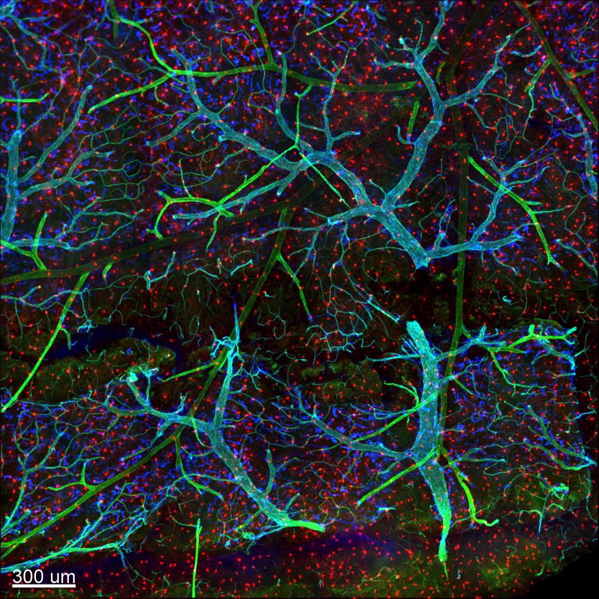 Meninges and underlying tissue in a mouse brain: Microglia (red) have a characteristic hairy structure. Blood vessels are in green