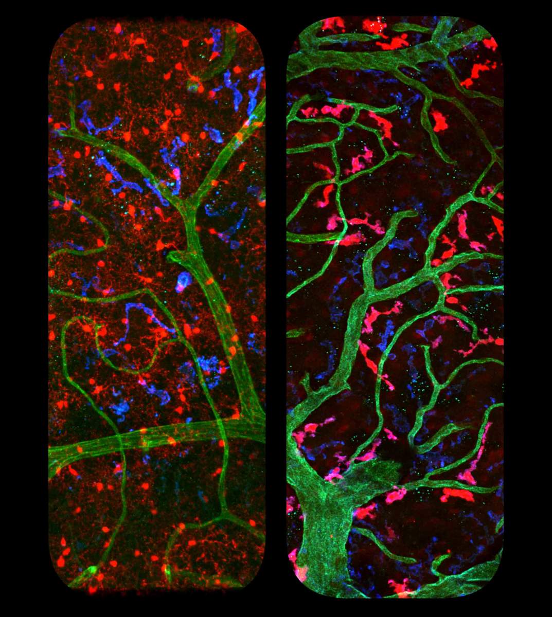 Macrophages (left) and perivascular macrophages (right) are each labeled red in separate experiments, revealing their different locations and shapes