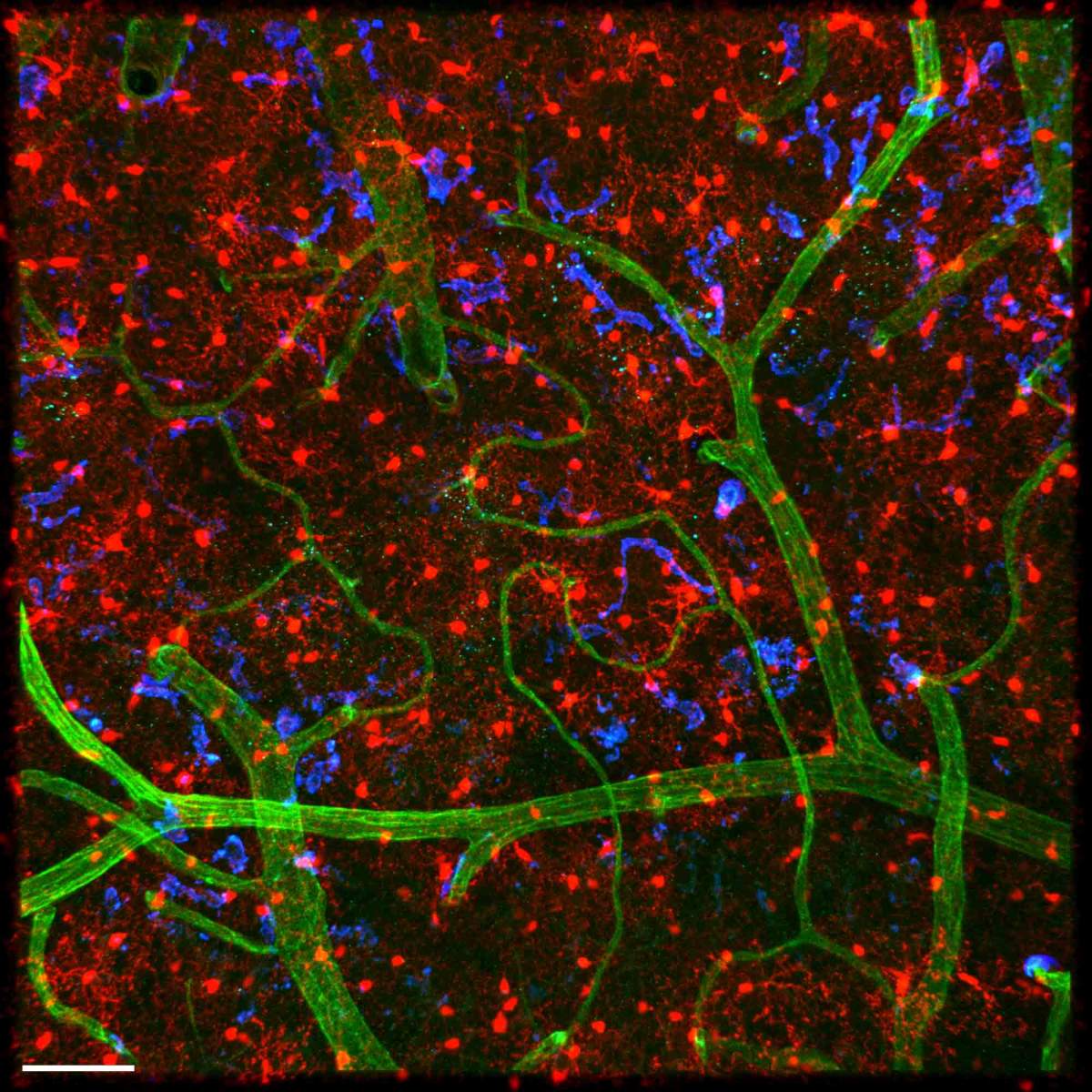 Meninges and underlying tissue in a mouse brain: Microglia (red) have a characteristic hairy structure. Blood vessels are in green