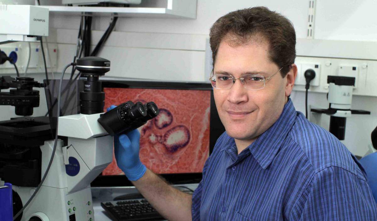 Dr. Valery Krizhanovsky is working on the cell death that could keep the body young