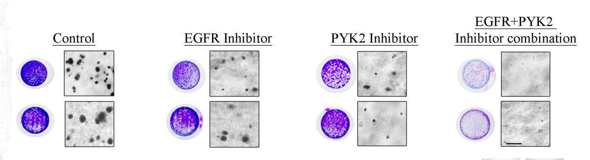 Combining two inhibitors (right) was much more effective than either alone in preventing cancer growth