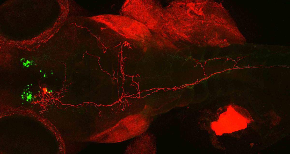 Fluorescent image of one nerve cell in red among the green revealed cells with bushy, many-branched extensions. Some of the axons – the extensions that conduct the signals – went all the way down to the fish’s tail