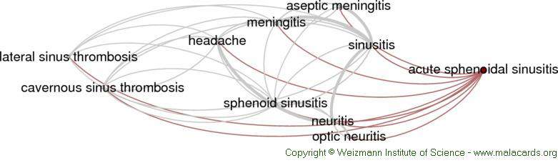 Graphical network of diseases related to acute sphenoidal sinusitis