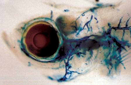Lymphatic system of an adult zebrafish, from the lab of Dr. Karina Yaniv