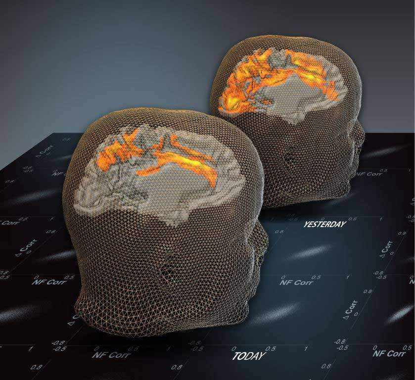 The day after effect of brain activation: The brain image at the back presents spontaneous (resting state) patterns before an fMRI-based neurofeedback training session. The front brain image presents spontaneous (resting state) patterns a day after the training session, illustrating the long-term trace of the training