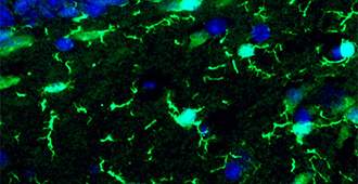 Microglia (bright green) in an adult mouse brain, viewed under a fluorescent microscope