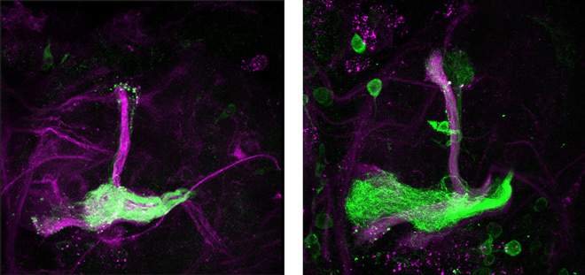 In the developing brain of the fruit fly, neuronal extensions (green) grow abundantly when nitric oxide levels are low (right), but not when these levels are high (left). Viewed under a confocal microscope
