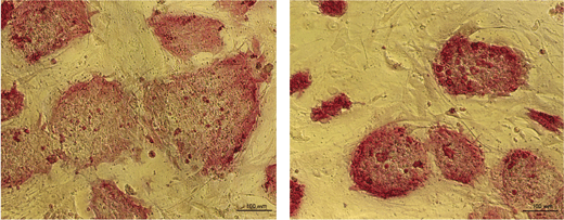מושבות תאי גזע עובריים כפי שהן נראות במיקרוסקופ: התאים התמיינו באופן מסודר כאשר הגנום שלהם הכיל עותק תקין של הגן p53 (משמאל), אך לא כאשר p53 היה חסר (מימין) 