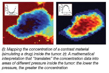 (l) Mapping the concentration of a contrast material (simulating a drug) inside the tumor. (r) A mathematical interpreation that "translates" the concentration data into areas of different pressure inside the tumor. the lower the pressure, the greater the concentration.