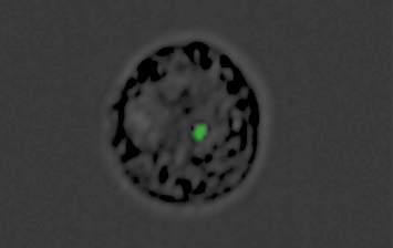 A monocyte converted into a decoy by the malaria parasite: The green dot is the genetic material “cargo” inside the nanovesicle produced by the parasite 