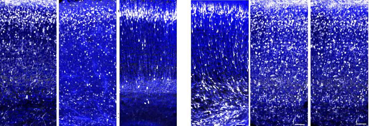 Neurons (white dots) in the brains of mouse embryos normally migrate in large numbers to the upper layer of the cortex (three panels on the left), but in the absence of the C3 protein, they remain dispersed along the migration route (three panels on the right). Viewed with confocal microscopy