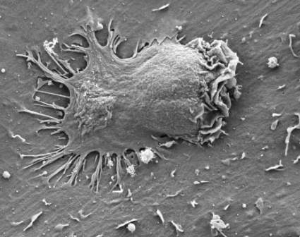 Electron microscope image of an effector cell inserting several appendages through endothelial cell membranes