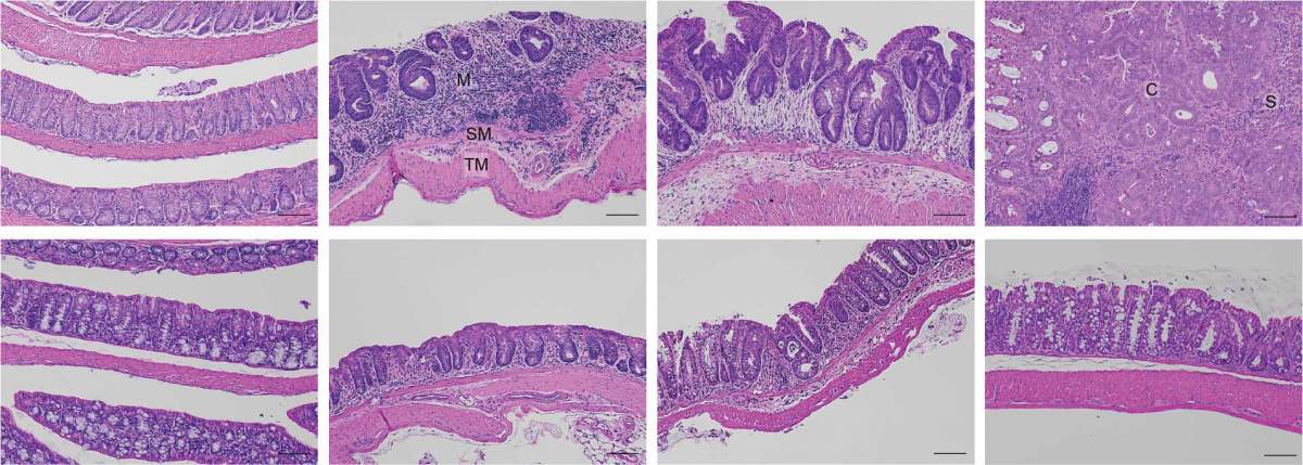 Lining of mouse gut under a microscope. That of regular mice (top left) becomes disorganized as chronic inflammation progresses (top, second and third from left), facilitating the development of cancer (top right). In mice lacking HSF1 (bottom left), inflammation fails to develop (bottom, second and third from left, and right)